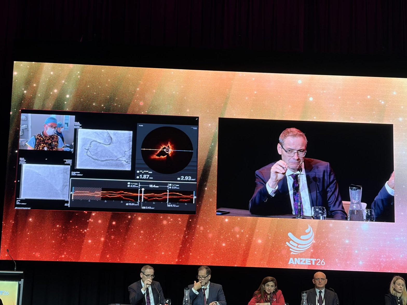 Panel discussion at ANZET with intravascular imaging displayed on the main screen